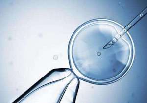 美國(guó)試管嬰兒的費(fèi)用大概要多少錢