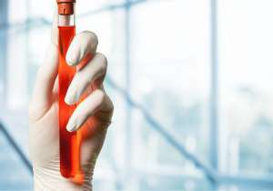 做試管嬰兒成功率該怎么提高