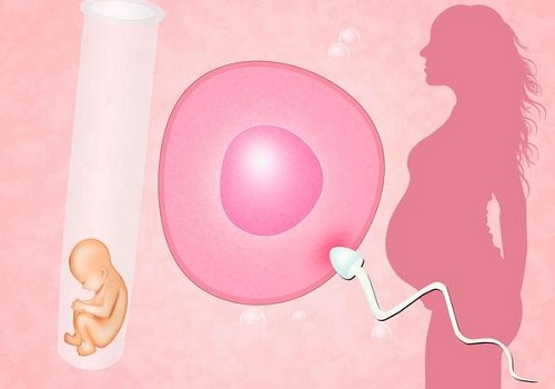 什么情況下需要延遲移植來保障試管嬰兒成功率呢