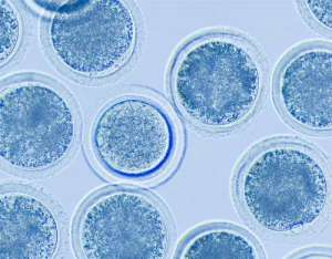 試管嬰兒是否能選擇