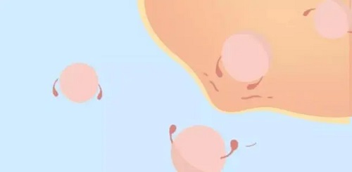 到泰國試管嬰兒需要做好哪些手續(xù)