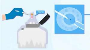 美國(guó)第三代試管嬰兒適合誰(shuí)