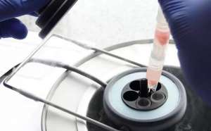 俄羅斯試管嬰兒費(fèi)用介紹